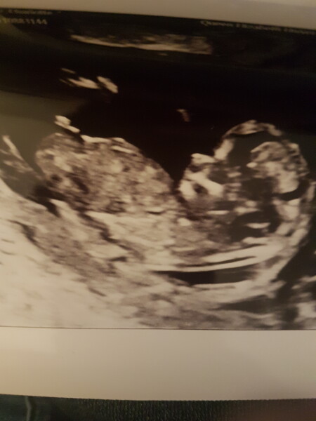 Due December 2022 thread 3