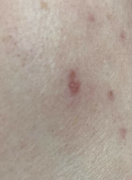 Should I get this checked out? 