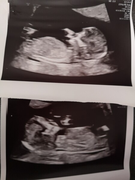 Just for fun. Scan prediction 