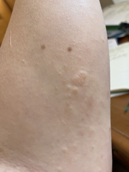 Anyone good at rashes/chronic skin complaints - visual diagnosis and suggestions for treatment please!