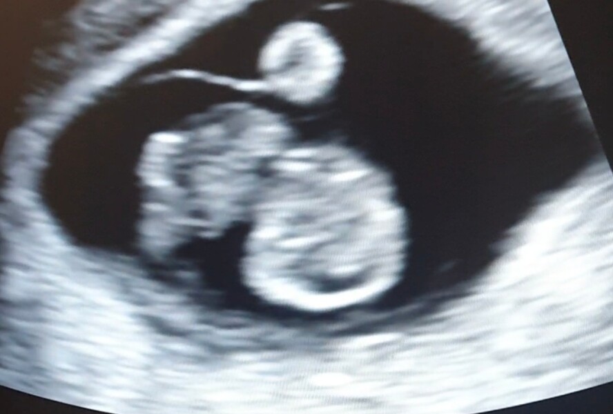 Due Jan 2023