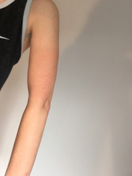 How did she get these arms?