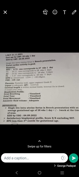 Bpd of child is lower