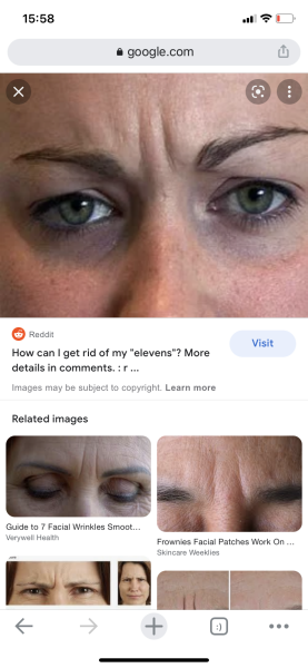 If you met a woman in her 50s without many wrinkles or "11s"....