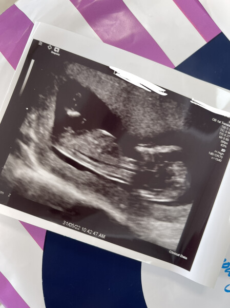 Due December '22 thread 2!