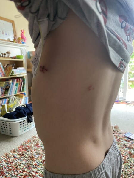 Maybe Bug bites? Really sore, picture attached 