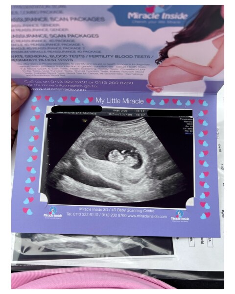 Guesses On Gender