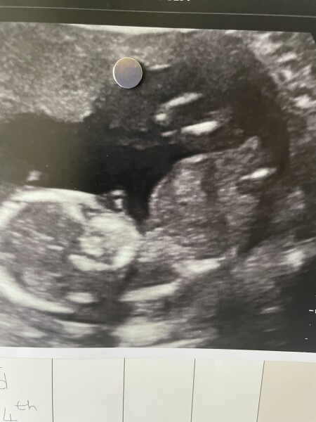 Does this picture work with nub theory? Guesses if so:-)