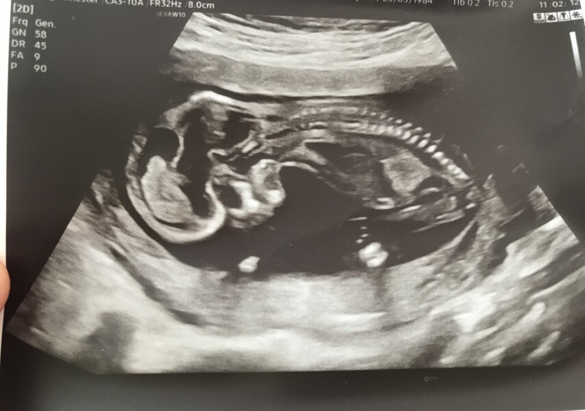 Due December 2022 thread 3