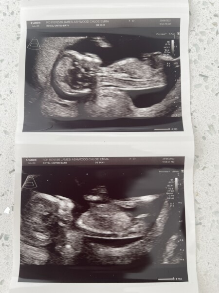 12wks 6days. Nub theory as I have no idea!