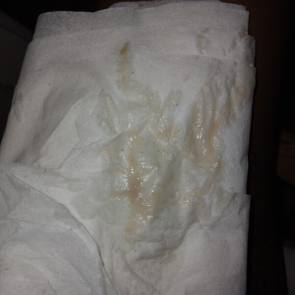 WARNING PIC&TMI implantation bleeding?