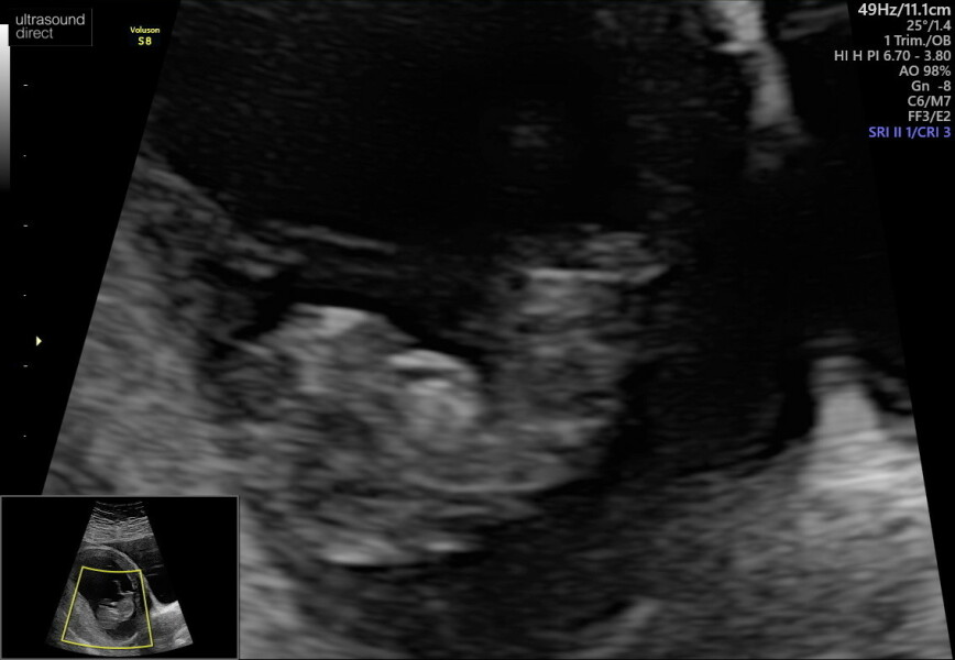 Baby January 2023!