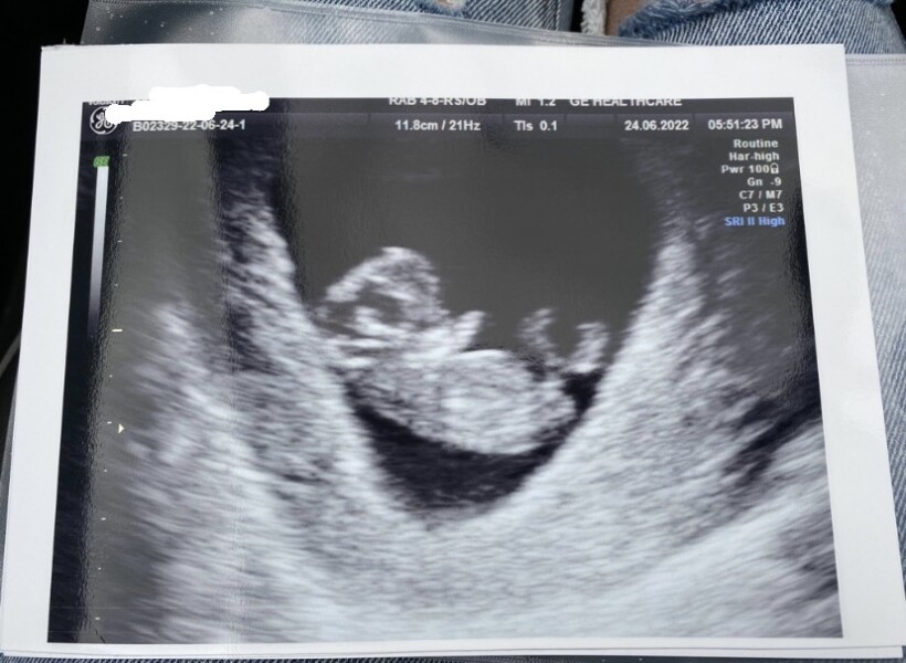 Due January 2023 👶🏼💜