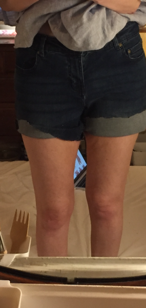 Shorts phobia, with leg pics.