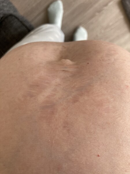 Pregnancy bumps