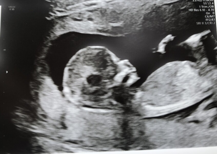 Due December '22 thread 2!