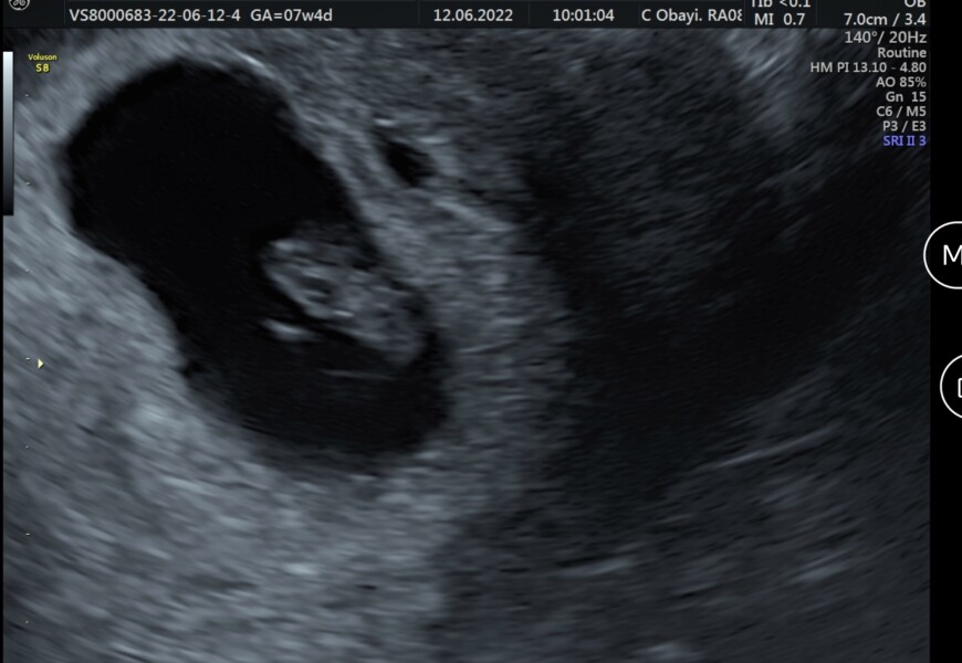 Our little blessing