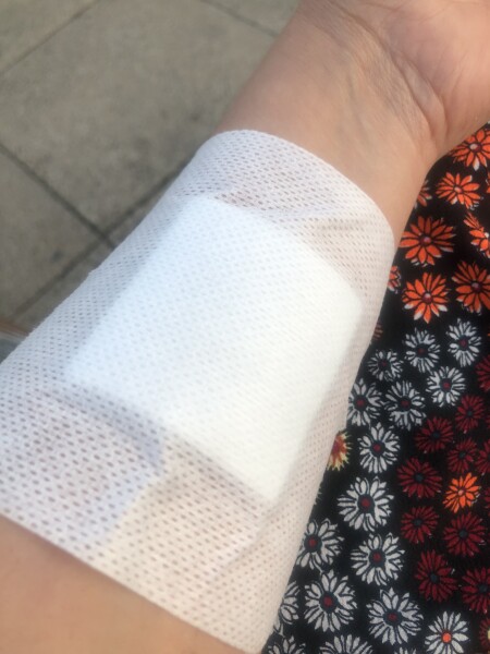 Does this look likes it’s healing? 
