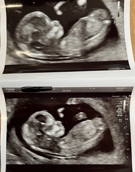 Due December 2022 thread 3
