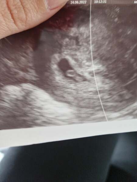 Hcg 1575 but nothing seen on scan!