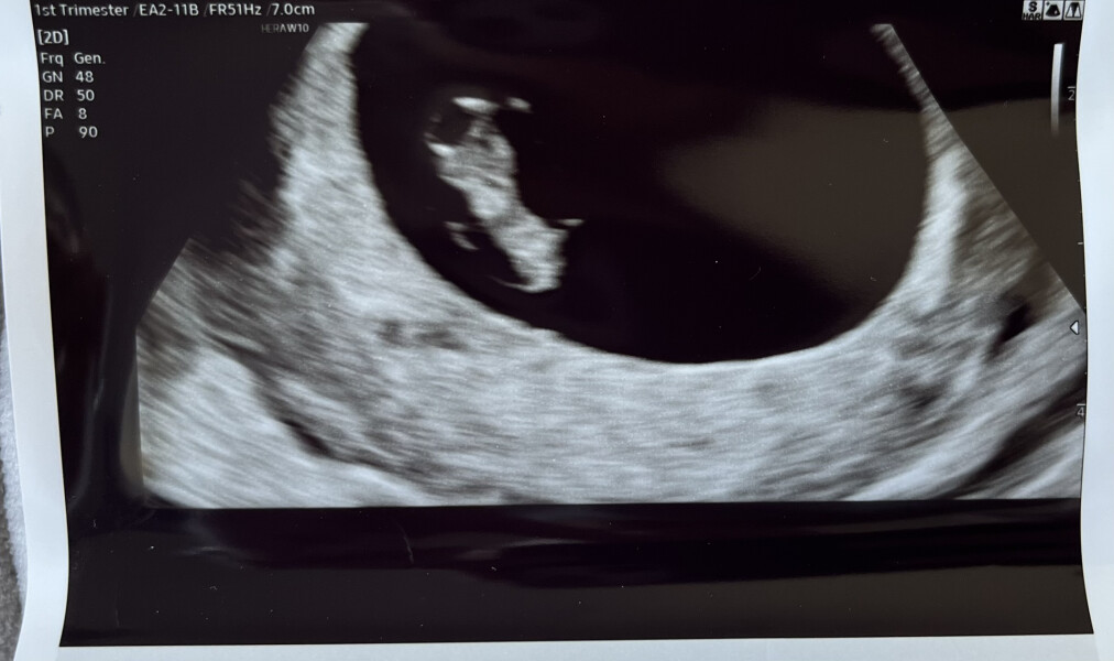 Due February 2023 ❤️💙💛💖