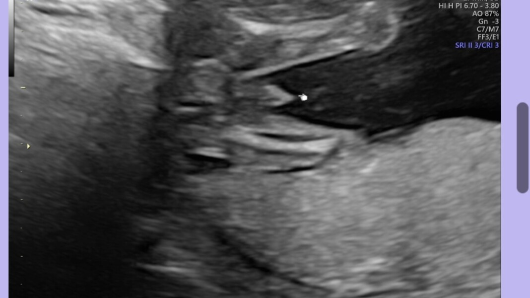 Guess baby’s gender from gender scan pic! 😍