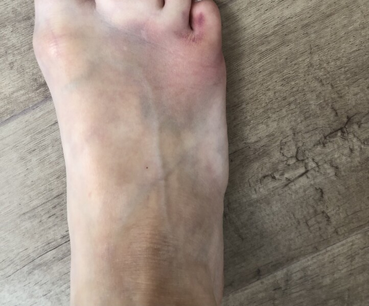Would you see a docter for this ? 