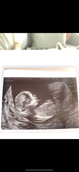 Gender guesses/nub theory? 