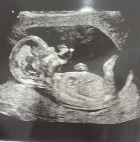 Due December 2022 thread 3