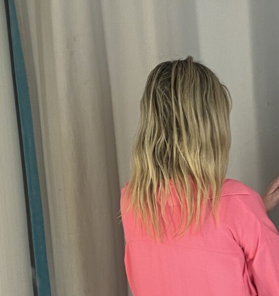 Can my hair be saved ? (Pics)