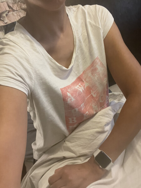 How did she get these arms?