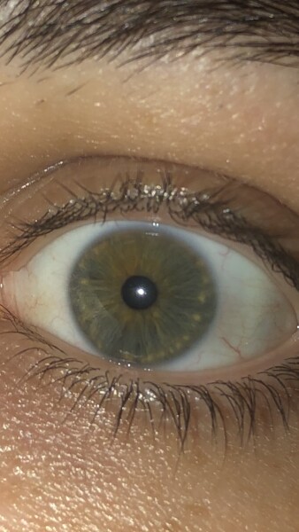 What colour is this eye?