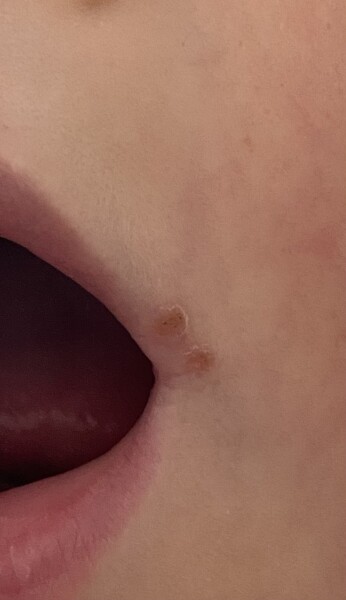 Pic not gross