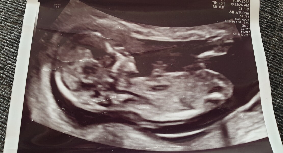 Due December 2022 thread 3
