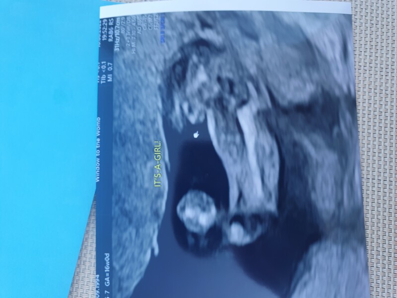 Scan photo boy or girl