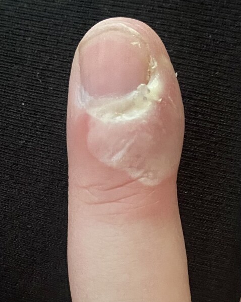 Medical help please! (TW: pic)