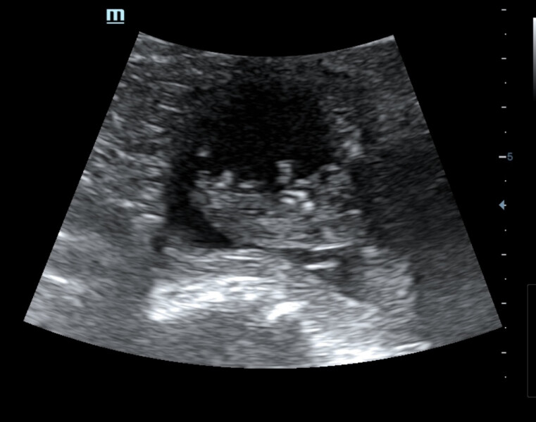 Really struggling with anxiety 10w3d