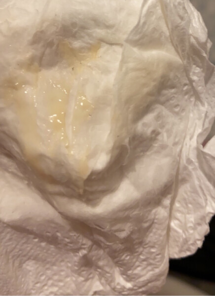 Mucus plug- photo attached