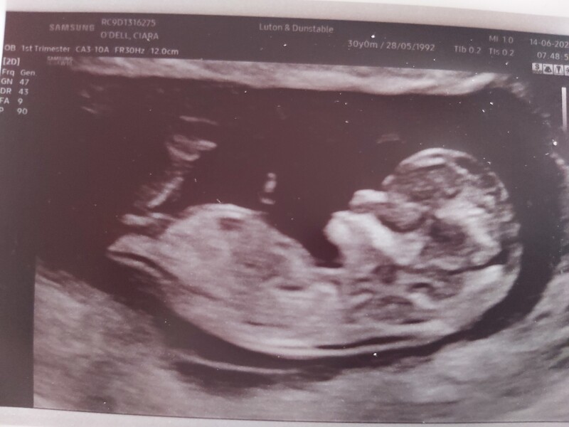 12+2 gender guess