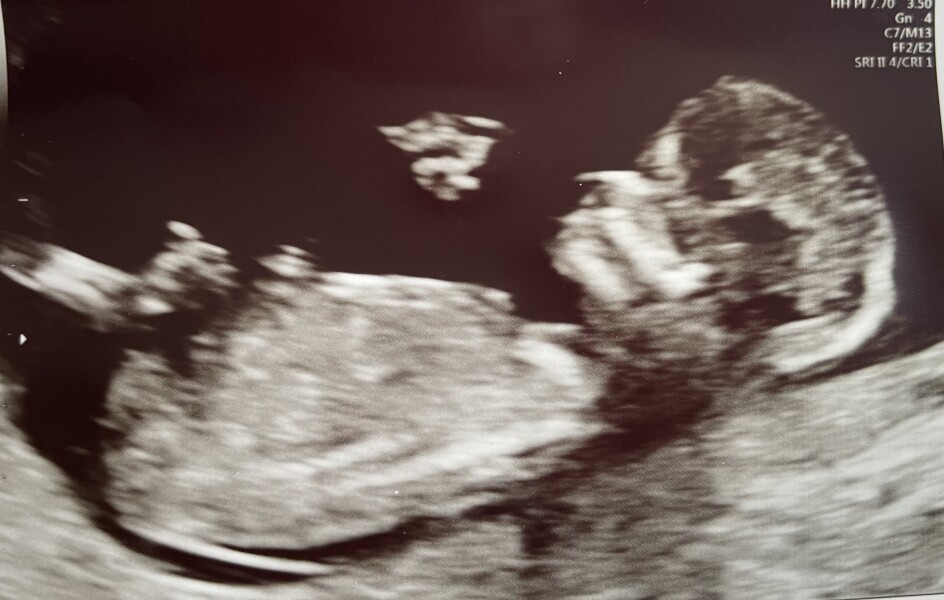 Due December 2022 thread 3