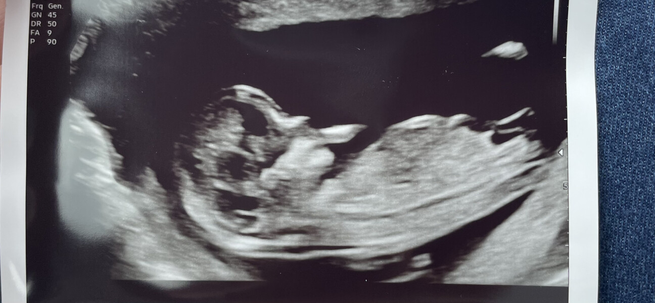 Due December 2022 thread 3