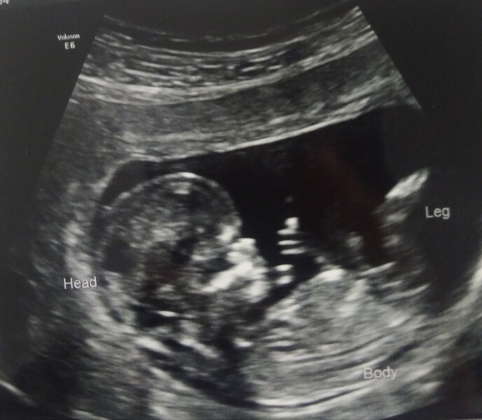 Boy or girl just for fun 