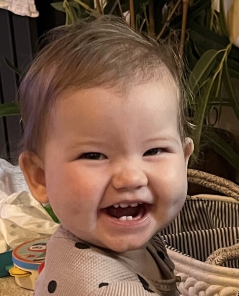 My baby has odd teeth??