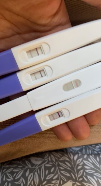 Failed abortion- now 22 weeks.