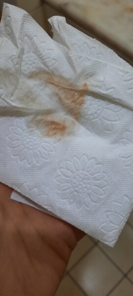 (TMI) Is this my implantation spotting? Help me please!
