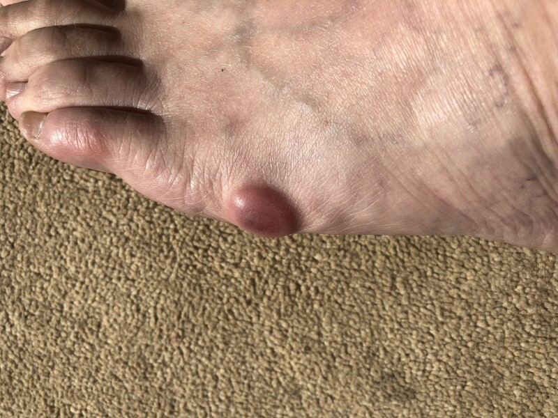 What is this? Pic inc.