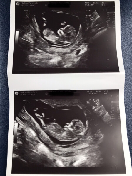 Due December '22 thread 2!
