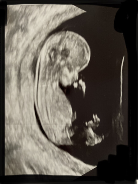 Due December '22 thread 2!