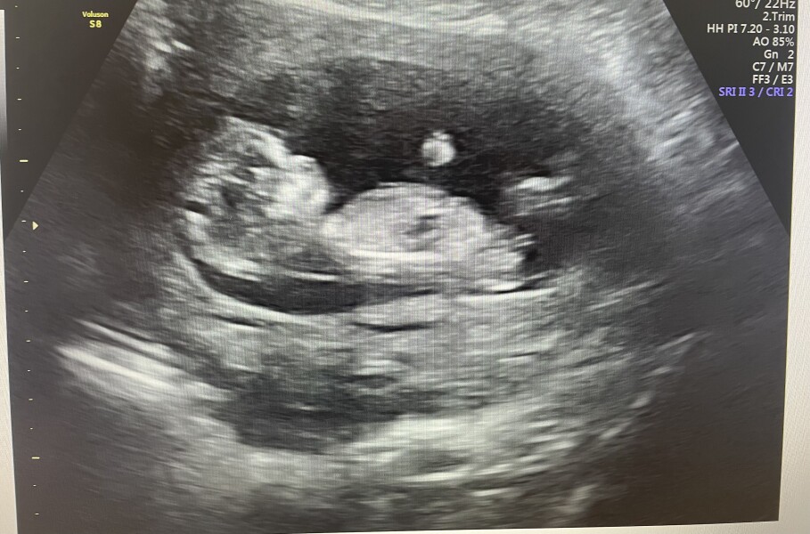 Due December 2022 thread 3