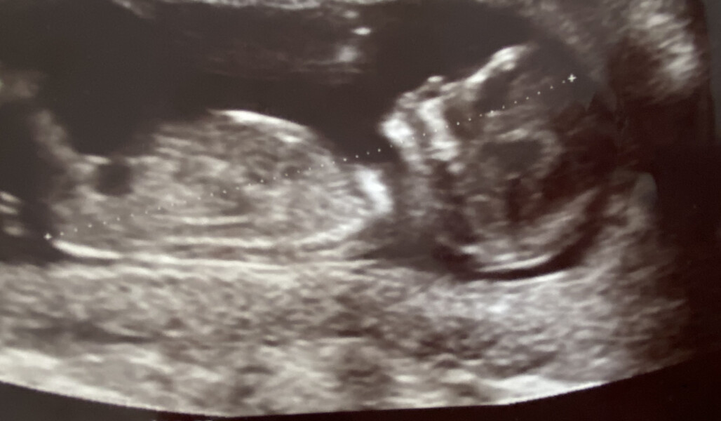 Due December 2022 thread 3